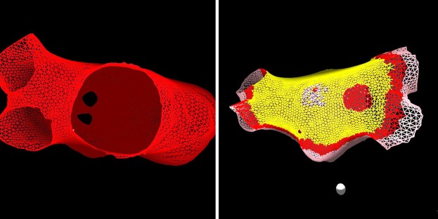 Patient-Specific Left Atrium